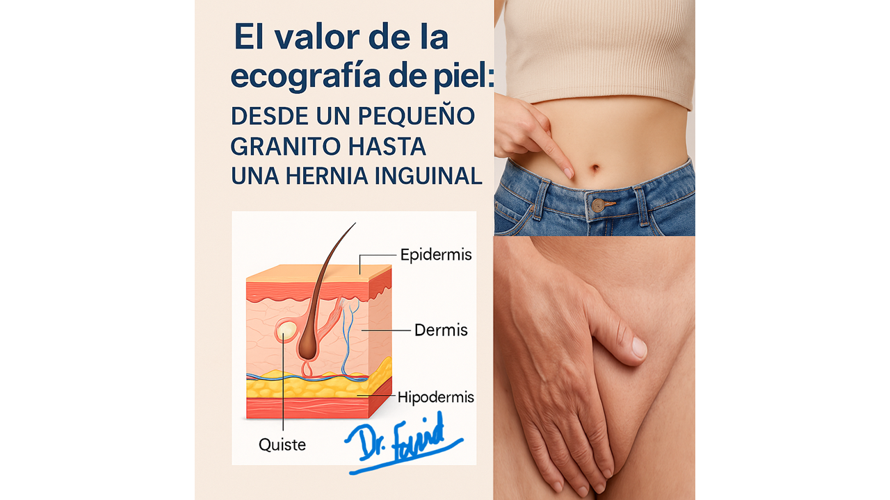Valor de la ecografia de la piel, desde un pequeño grano debajo de la piel a una hernia inguinal