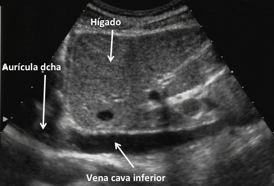 La ecografia en manos del médico internista es el chequeo más completo