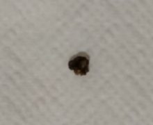 la imagen de la piedra, expulsada por orina, aportada por la paciente